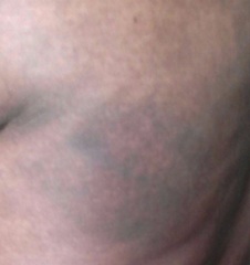 Foto de Cidadão Repórter