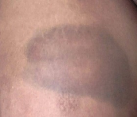 Foto de Cidadão Repórter